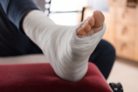 Consulting a Podiatrist for a Foot Fracture